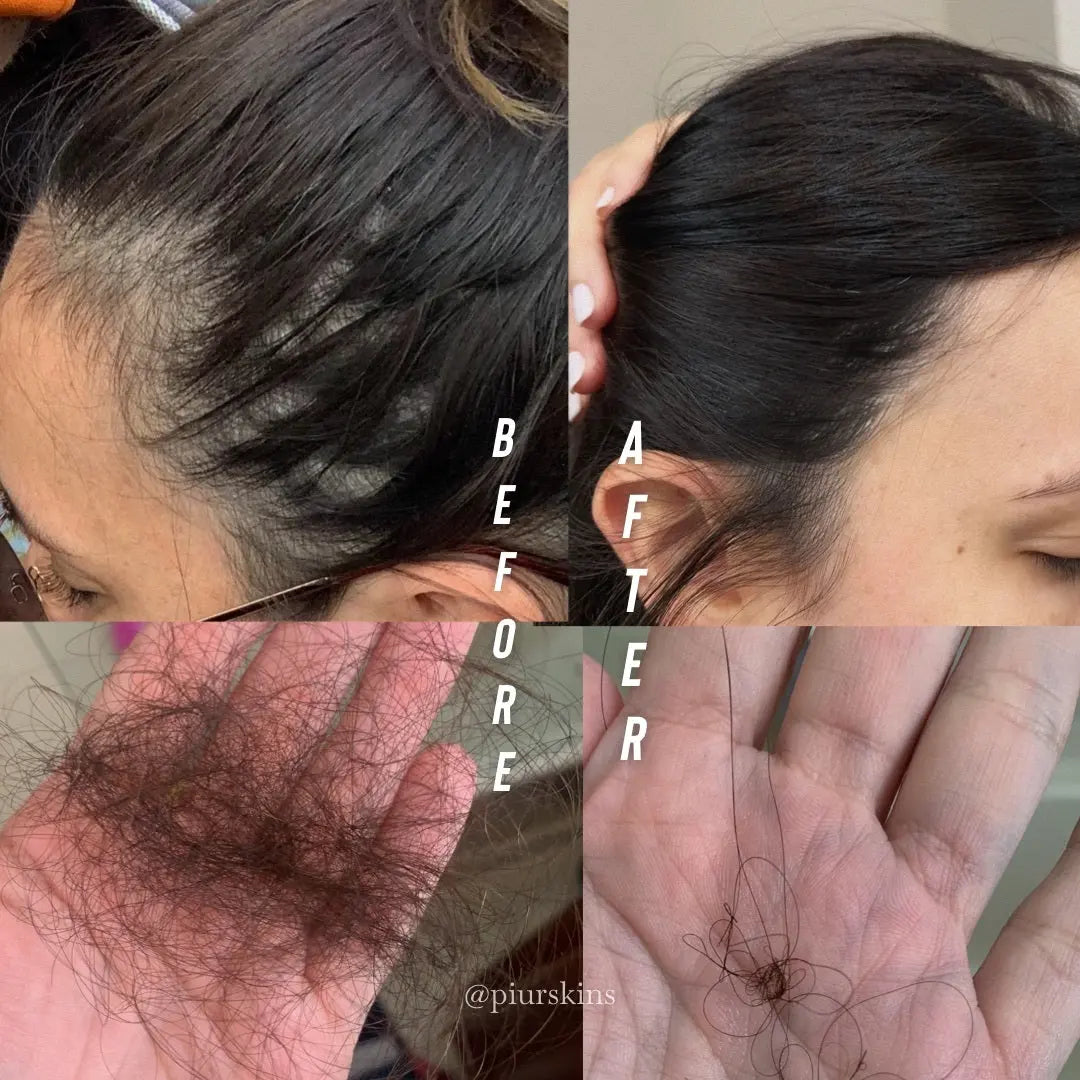 Triple Strength Hair Revive - Piur Skins